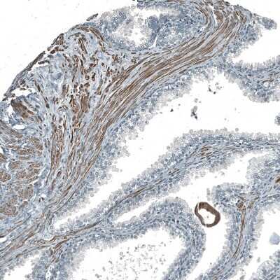 Immunohistochemistry-Paraffin: PIGA Antibody [NBP2-13760]