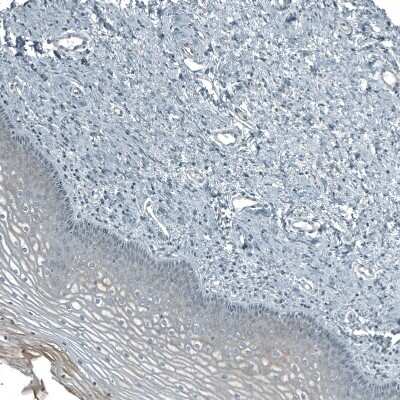 Immunohistochemistry-Paraffin: PIGA Antibody [NBP2-13760]