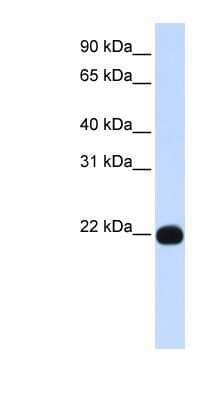 Western Blot: PIGA Antibody [NBP1-59701]