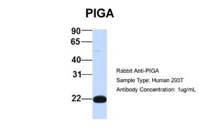 Western Blot: PIGA Antibody [NBP1-59701]