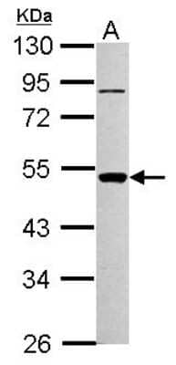 Western Blot: PIGA Antibody [NBP2-19827]