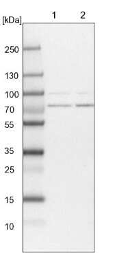 Western Blot: PIGB Antibody [NBP1-85856]