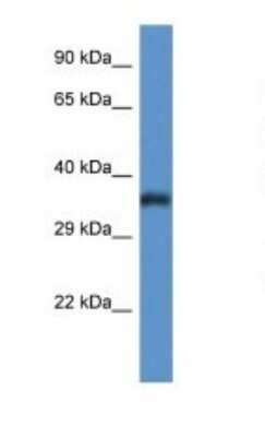 Western Blot: PIGC Antibody [NBP1-79871]