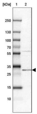 Western Blot: PIGC Antibody [NBP1-86283]