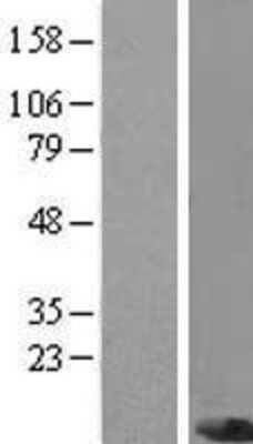 Western Blot: PIGC Overexpression Lysate [NBP2-10011]