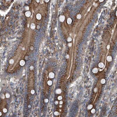 Immunohistochemistry: PIGH Antibody [NBP1-83342]