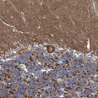 Immunohistochemistry-Paraffin: PIGH Antibody [NBP1-83342]