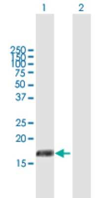 Western Blot: PIGH Antibody [H00005283-B01P]