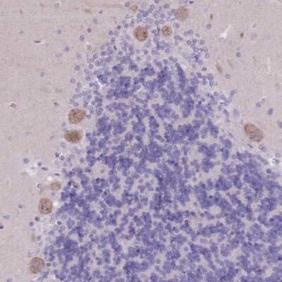 Immunohistochemistry-Paraffin: PIGM Antibody [NBP2-13761]