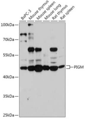 Western Blot: PIGM AntibodyAzide and BSA Free [NBP2-94070]