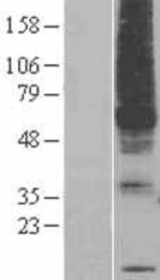 Western Blot: PIGM Overexpression Lysate [NBP2-05498]