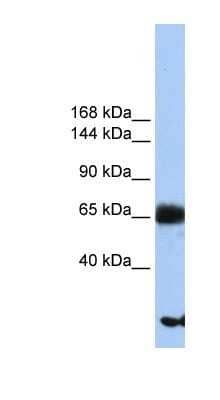 Western Blot: PIGO Antibody [NBP1-62446]