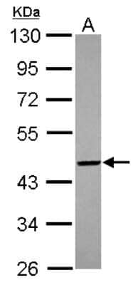 Western Blot: PIGO Antibody [NBP2-19828]