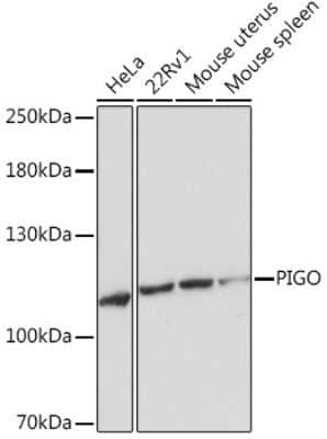 Western Blot: PIGO AntibodyAzide and BSA Free [NBP3-15587]