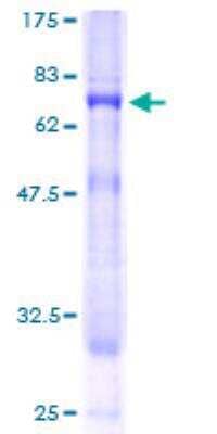 SDS-PAGE: Recombinant Human PIGO GST (N-Term) Protein [H00084720-P01]