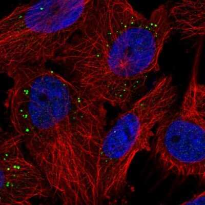 Immunocytochemistry/ Immunofluorescence: PIGP Antibody [NBP1-84294]