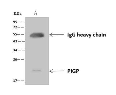 Immunoprecipitation: PIGP Antibody [NBP3-06346]