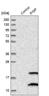 Western Blot: PIGP Antibody [NBP1-84294]