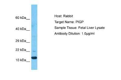 Western Blot: PIGP Antibody [NBP2-85475]
