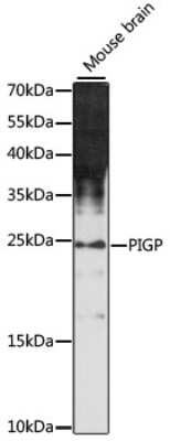 Western Blot: PIGP AntibodyAzide and BSA Free [NBP2-94792]