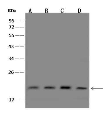 Western Blot: PIGP Antibody [NBP3-06346]