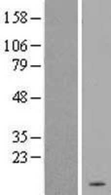 Western Blot: PIGP Overexpression Lysate [NBL1-14405]
