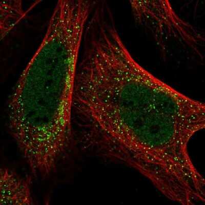 Immunocytochemistry/ Immunofluorescence: PIGQ Antibody [NBP1-83344]