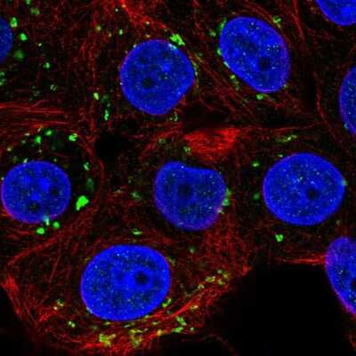 Immunocytochemistry/ Immunofluorescence: PIGQ Antibody [NBP2-55743]