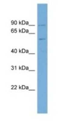 Western Blot: PIGQ Antibody [NBP1-59738]