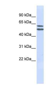 Western Blot: PIGQ Antibody [NBP1-59740]