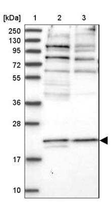 Western Blot: PIGQ Antibody [NBP1-83343]