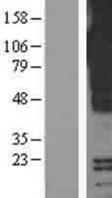 Western Blot: pIgR Overexpression Lysate [NBP2-04232]