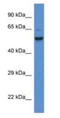 Western Blot: PIGS Antibody [NBP1-74155]