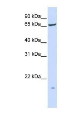 Western Blot: PIGT Antibody [NBP1-69585]