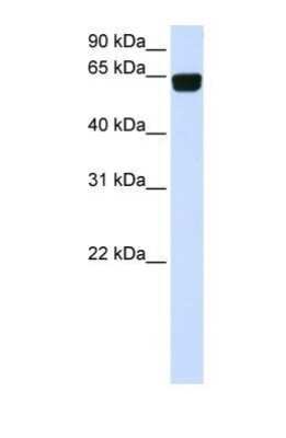 Western Blot: PIGT Antibody [NBP1-69642]