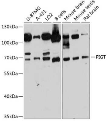 Western Blot: PIGT AntibodyAzide and BSA Free [NBP2-93803]