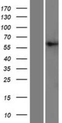 Western Blot: PIGT Overexpression Lysate [NBP2-07107]