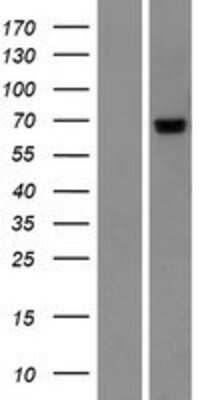 Western Blot: PIGT Overexpression Lysate [NBP2-10256]