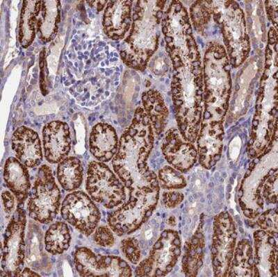 Immunohistochemistry: PIGU Antibody [NBP2-30386]