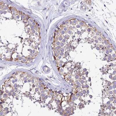 Immunohistochemistry-Paraffin: PIGU Antibody [NBP2-30386]