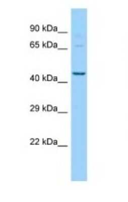 Western Blot: PIGU Antibody [NBP1-98429]