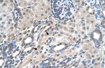 Immunohistochemistry-Paraffin: PIGV Antibody [NBP1-62449]