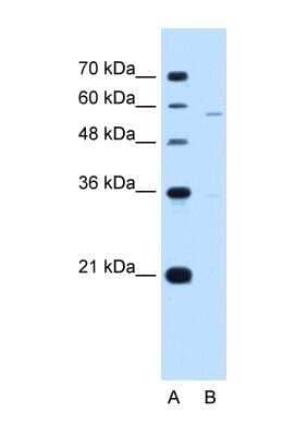 Western Blot: PIGV Antibody [NBP1-62449]