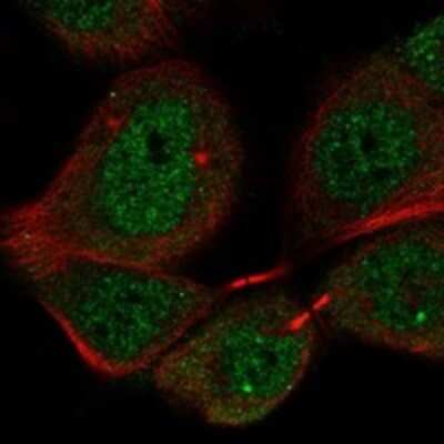 Immunocytochemistry/ Immunofluorescence: PIGX Antibody [NBP3-17290]