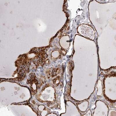 Immunohistochemistry-Paraffin: PIGX Antibody [NBP1-83647]