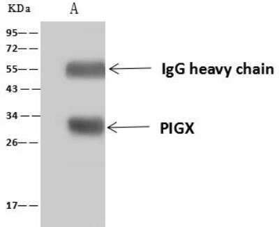 Immunoprecipitation: PIGX Antibody [NBP3-12593]