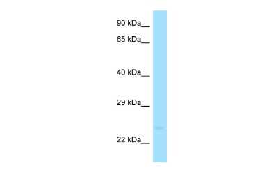 Western Blot: PIGX Antibody [NBP2-83395]