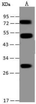 Western Blot: PIGX Antibody [NBP3-12593]