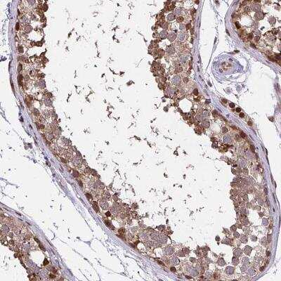 Immunohistochemistry-Paraffin: PIGY Antibody [NBP2-32415]