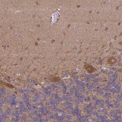 Immunohistochemistry: PIGZ Antibody [NBP2-32502]